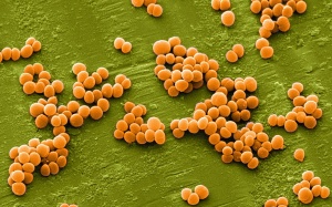 Phát hiện thực phẩm chay nhiễm độc tố tụ cầu vàng